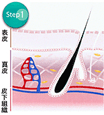 横浜のエステサロンで美肌作りstep1